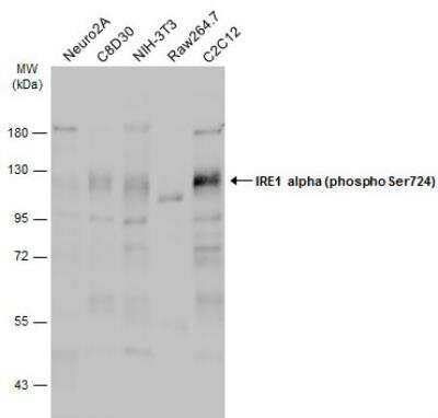 Western Blot: IRE1 alpha [p Ser724] Antibody [NBP3-12124]